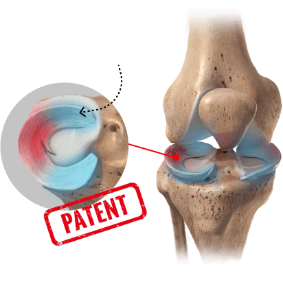 Condrocitos orgánicos